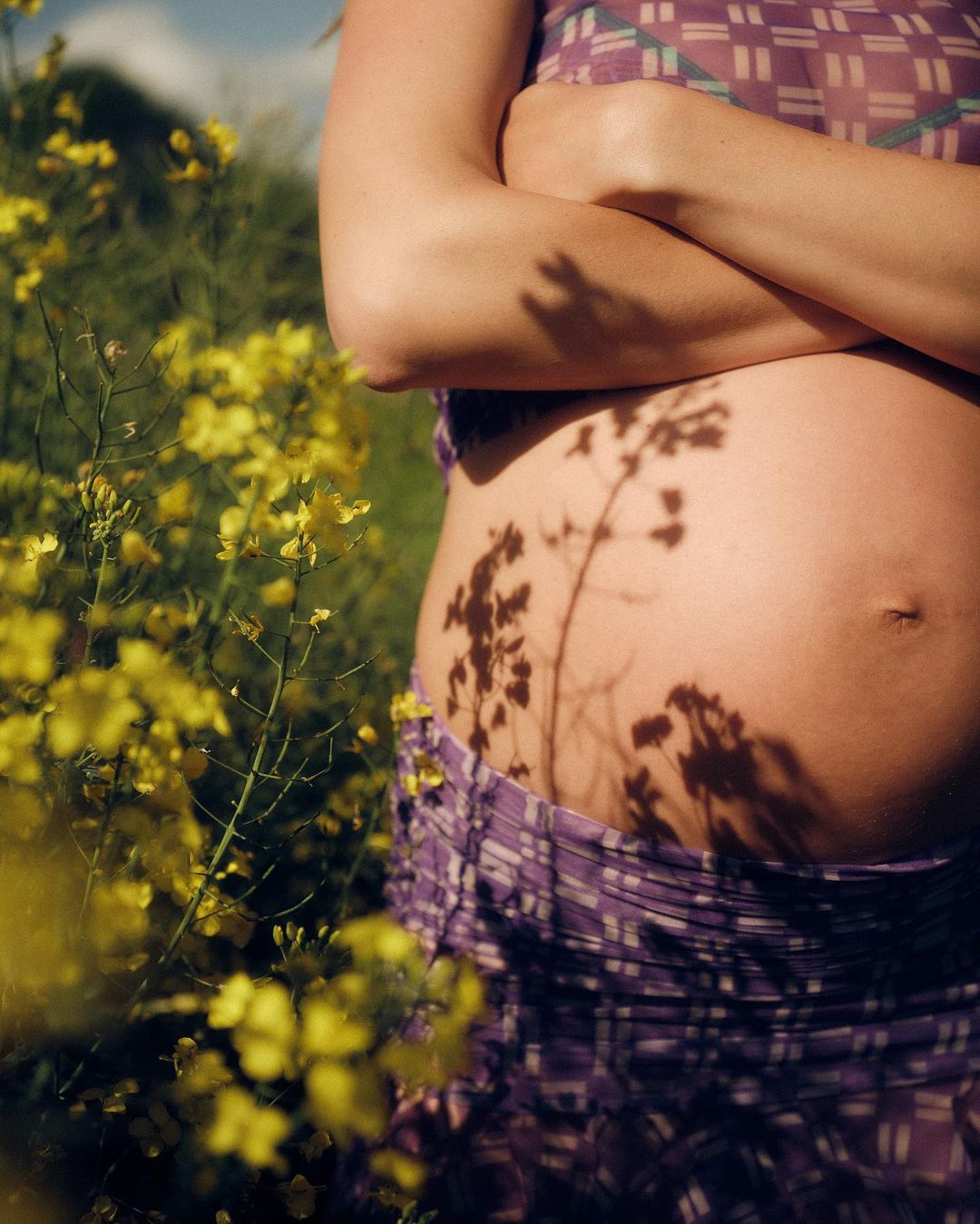 Close-up of a pregnant woman with arms crossed standing in a field of yellow flowers, a shadow of the plant falling on her stomach.