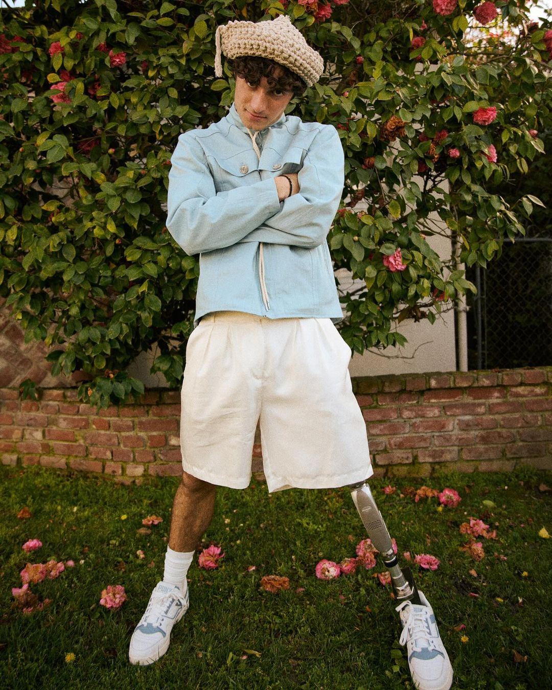 Young adult male poses in outdoor setting with a prosthetic leg, wearing a light blue jacket, white shorts, and a unique beige hat.