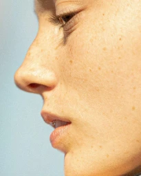 Extreme close up side profile portrait of a woman showing natural freckles and skin texture by Laurent Castellani