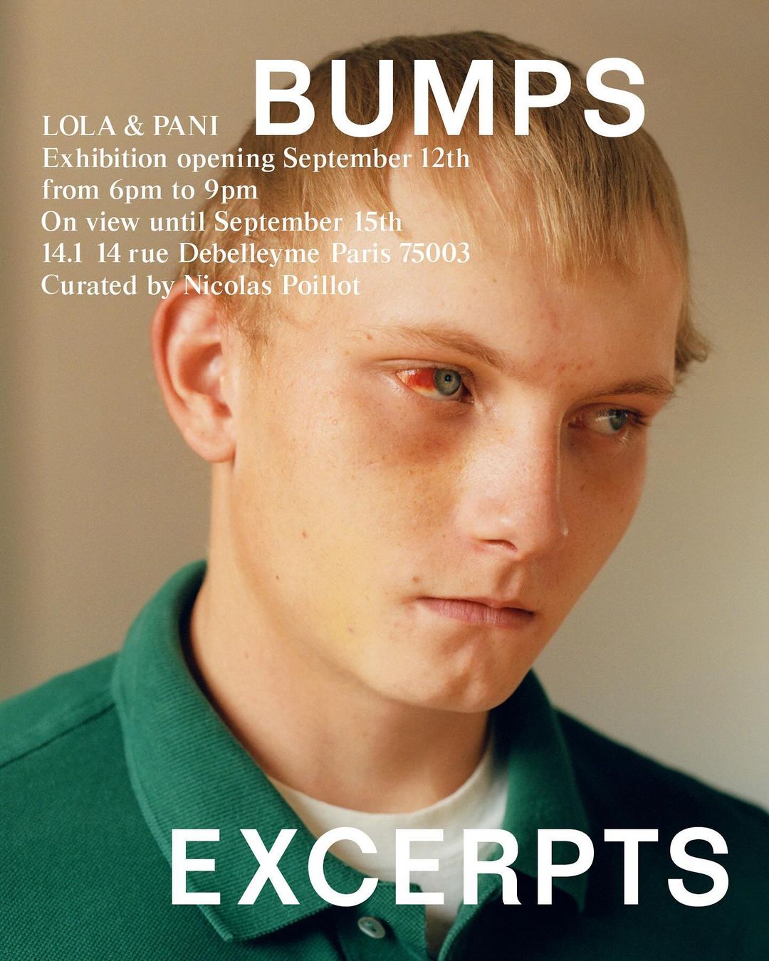 Close-up studio shot of a young adult with red irritation in one eye, wearing a green polo shirt against a beige background. Exhibition poster.