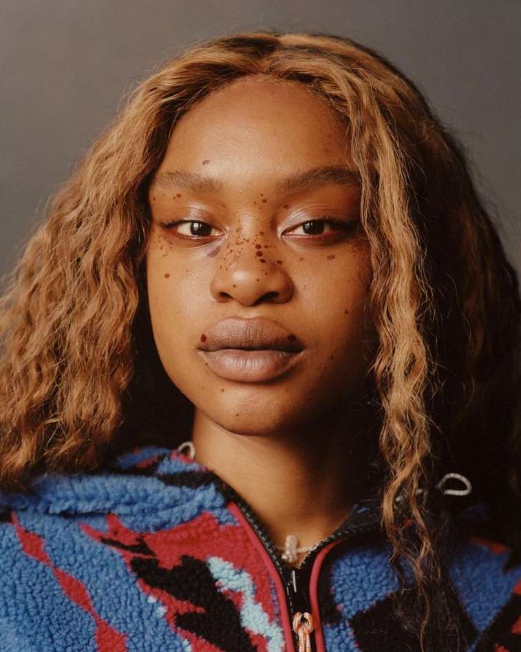 Portrait of a young adult woman with freckles and blonde wavy hair, wearing a patterned fleece zip-up, against a grey background.