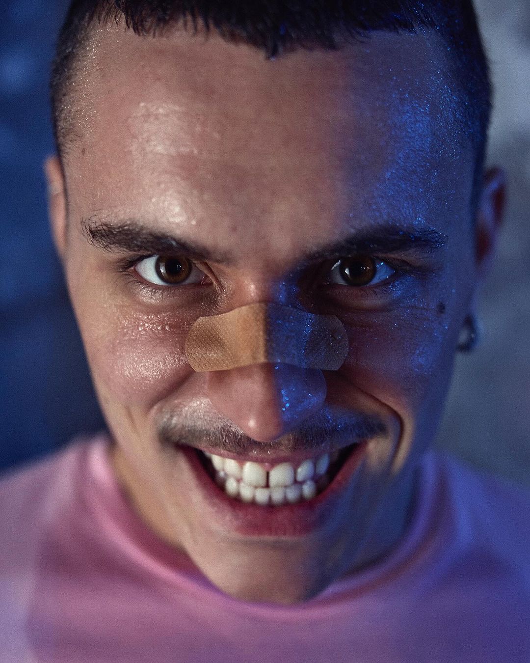 Close-up of a man with a bandage on his nose, smiling with his teeth showing and a pink t-shirt in a dimly lit, indoor environment.
