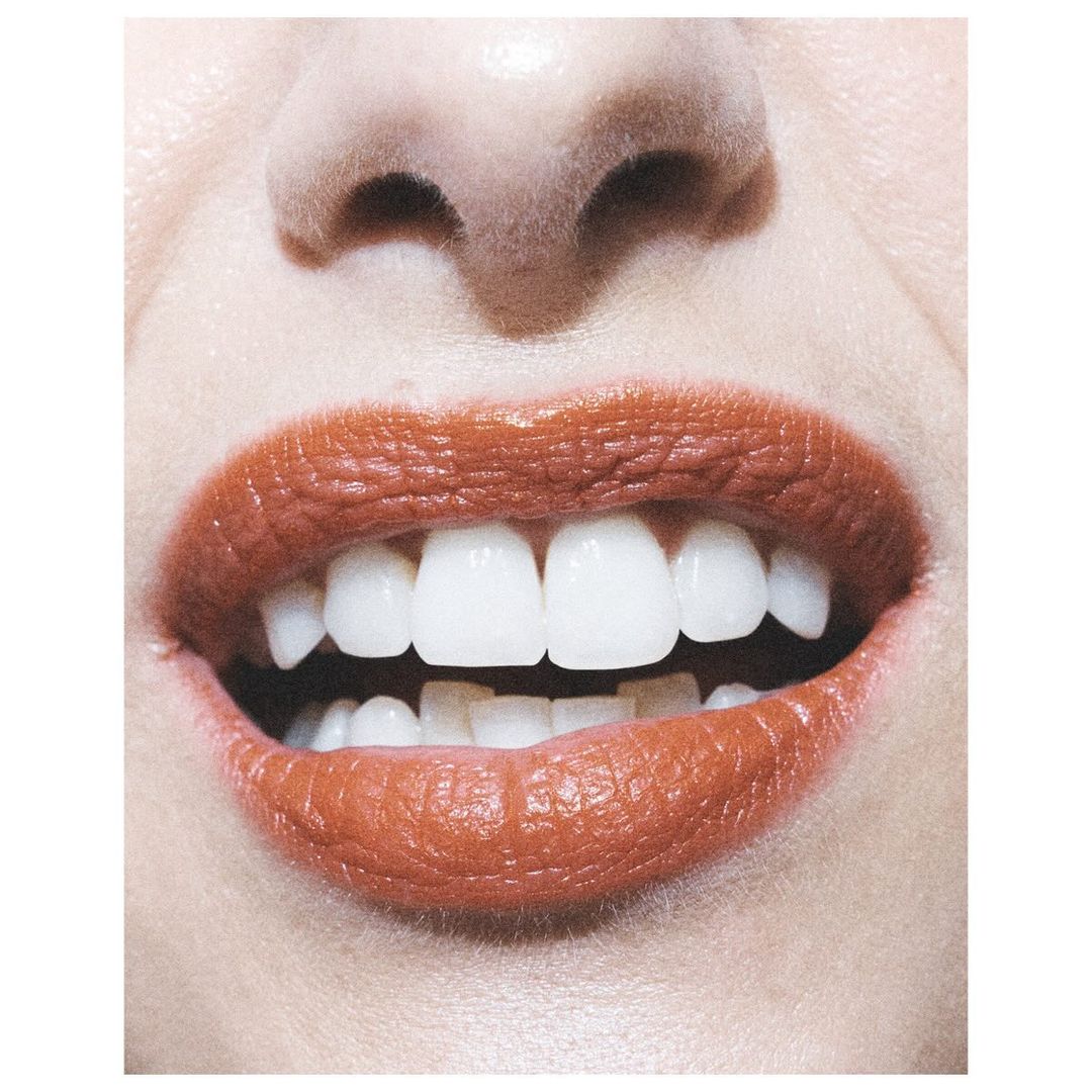 Close-up of a woman's face highlighting the mouth with lipstick and showing straight, white teeth, focusing on dental aesthetics.