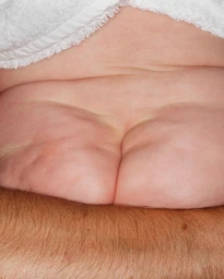 Close-up macro shot of human skin texture with a white towel draped across the top edge.
