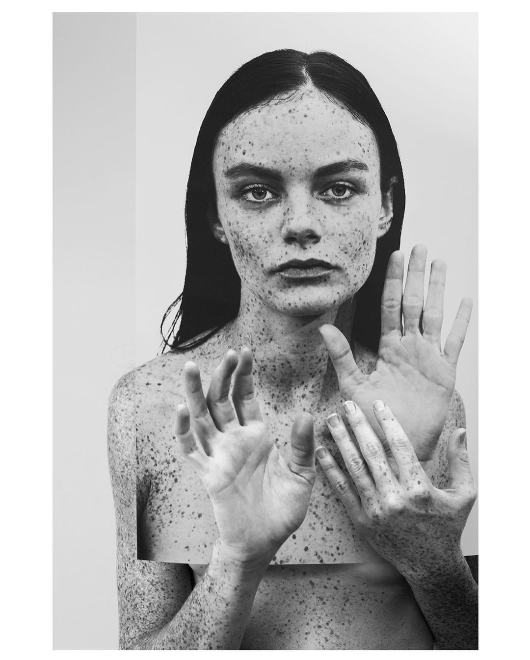 Monochrome portrait of a woman with freckles posing with her hands against a plain white background in a studio setting.