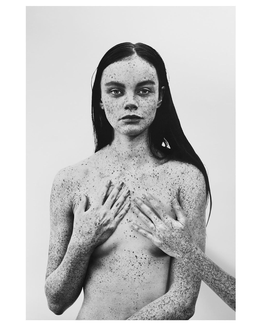 Monochrome portrait of a young woman with long, dark hair and skin markings, posing with a hand covering part of her chest in a studio setting.