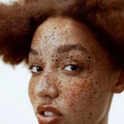 Close-up portrait of a woman with dense freckles and voluminous reddish-brown hair against a plain white background.