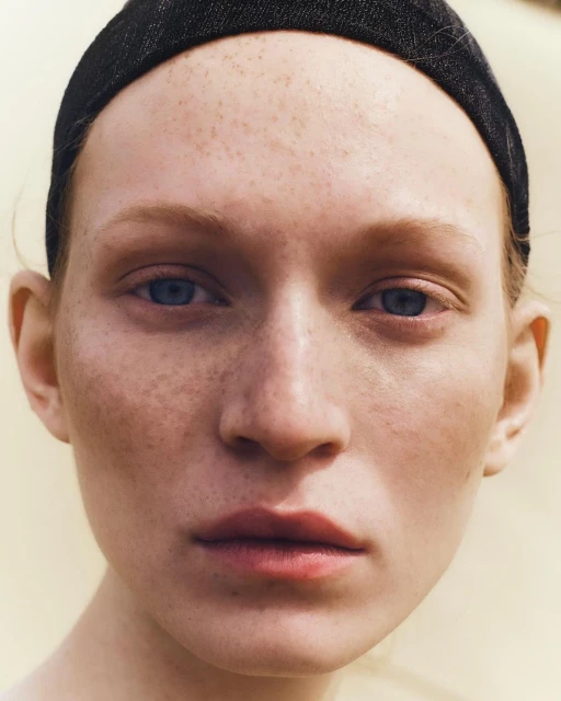 Close-up portrait of a woman with freckles and a black headband. The shot focuses on her face against a light yellow background.