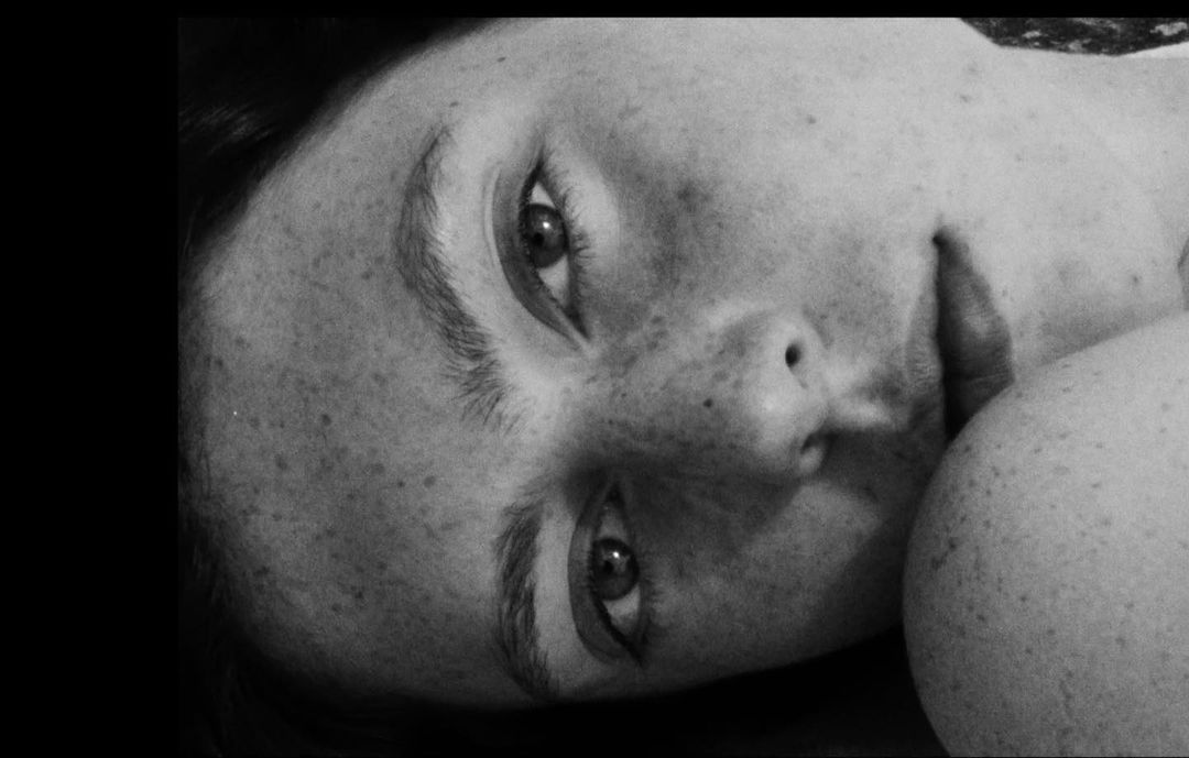 Close-up black and white portrait of a woman with prominent freckles looking towards the camera.