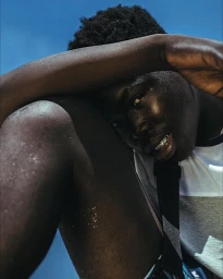 Portrait of a Black man with braces resting his head against his arm under a clear blue sky