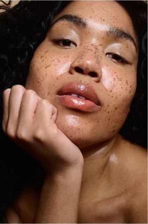 Close-up portrait of a woman with heavy freckles resting her chin on her hand against a dark background by Monika Lis