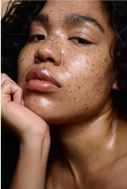 Close-up of a light-skinned adult female with freckles, glossy lips, and curly dark hair, with a direct gaze and chin resting on hand.