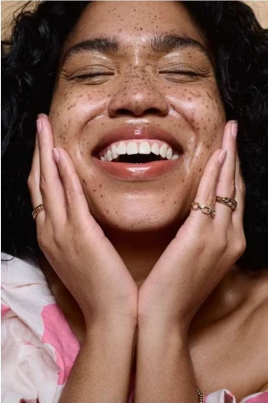 Close-up portrait of a smiling woman with heavy freckles holding her face with both hands, wearing gold chain rings.