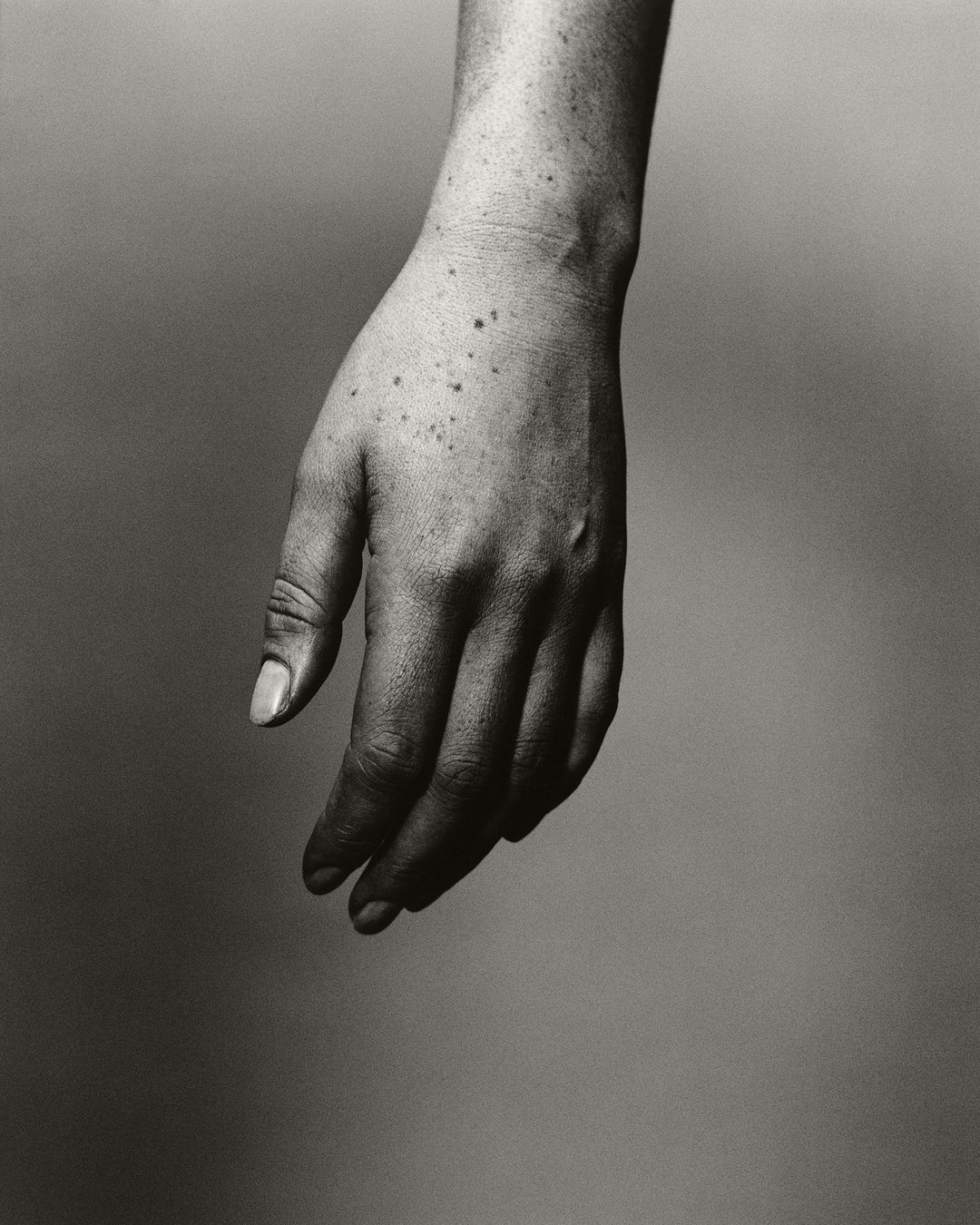 Monochromatic photograph of a light-skinned adult hand with freckles and visible veins against a neutral gray backdrop.