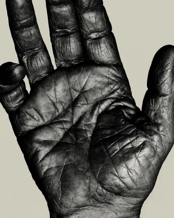 Close-up photograph of a dark-skinned human hand displaying detailed textures, lines, and ridges against a neutral background.