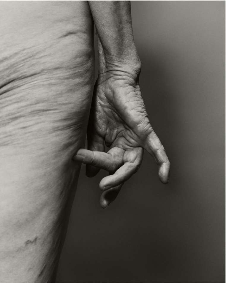Monochrome photograph of an elderly adult human's torso and hand against a plain background, showcasing skin texture and detail.