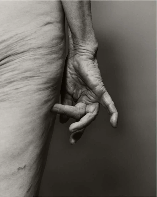 Monochrome photograph of an elderly adult human's torso and hand against a plain background, showcasing skin texture and detail.