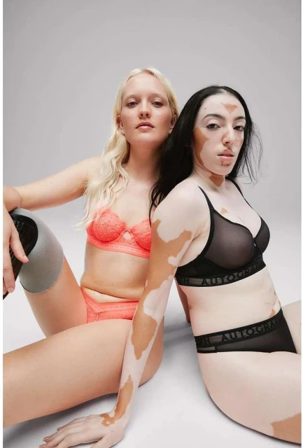 Two women pose in lingerie in a bright studio: one with a prosthetic leg and the other with vitiligo, fashion, and body positivity.