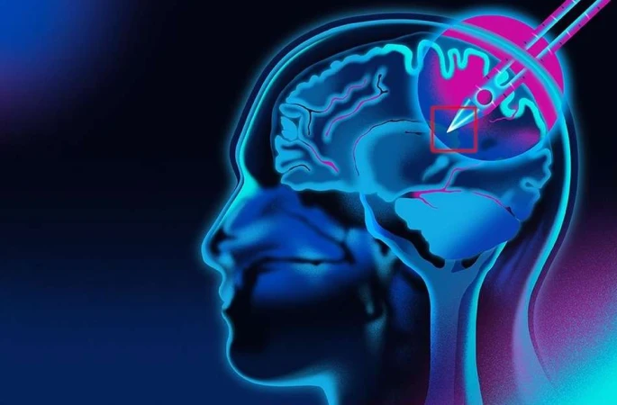 Medical illustration depicting a brain injection procedure with a syringe, rendered in blue and pink neon against a dark background.