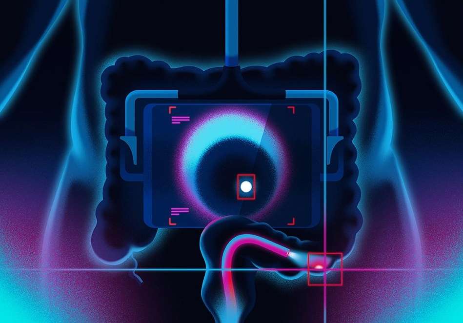 Medical scan illustration showing human intestines with illuminated areas highlighted on a digital scanner screen with a black backdrop.