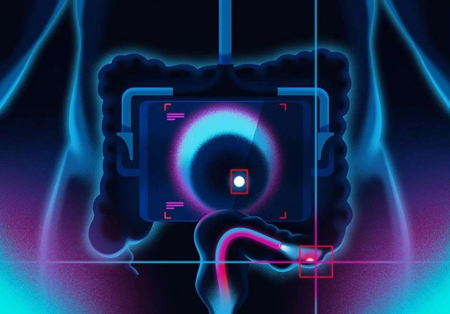 Medical scan illustration showing human intestines with illuminated areas highlighted on a digital scanner screen with a black backdrop.