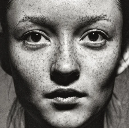 Extreme close-up monochrome portrait of a woman's face covered in detailed freckles with direct high-contrast lighting by Patric Shaw.