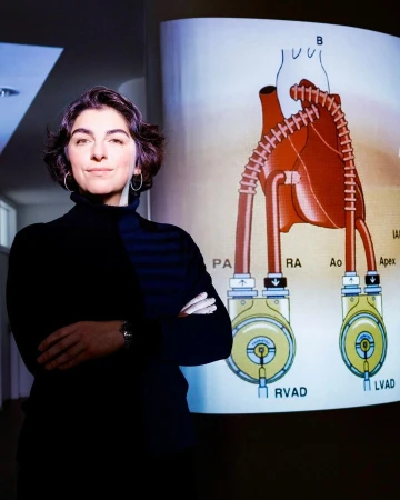 Adult woman with crossed arms stands in front of medical diagram of a heart with external ventricular assist devices (RVAD and LVAD).