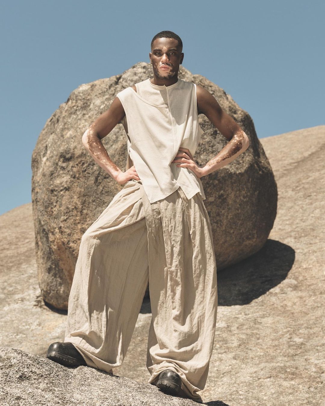 A man with vitiligo poses confidently in flowing beige clothing and black shoes against a large boulder under a clear blue sky.