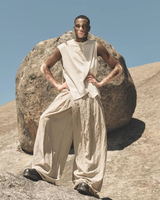 A man with vitiligo poses confidently in flowing beige clothing and black shoes against a large boulder under a clear blue sky.