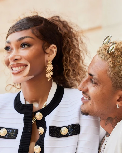 A fashionable couple poses indoors. The woman has vitiligo and wears a white jacket and gold earrings. The man has blond curly hair and tattoos.
