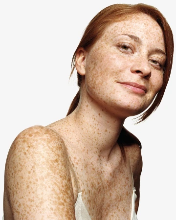 Portrait of a woman with red hair and heavy freckles across her face, shoulders, and chest against a white background.