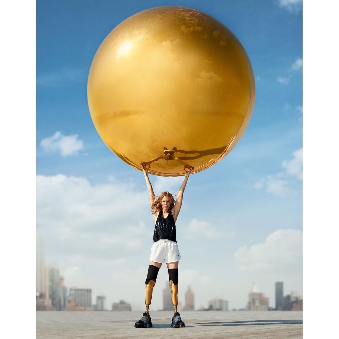 A blond woman with prosthetic legs stands outdoors lifting a giant gold balloon overhead, city buildings and a blue sky are in the background.