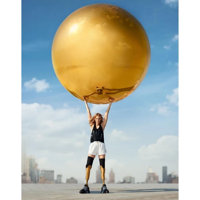 A blond woman with prosthetic legs stands outdoors lifting a giant gold balloon overhead, city buildings and a blue sky are in the background.