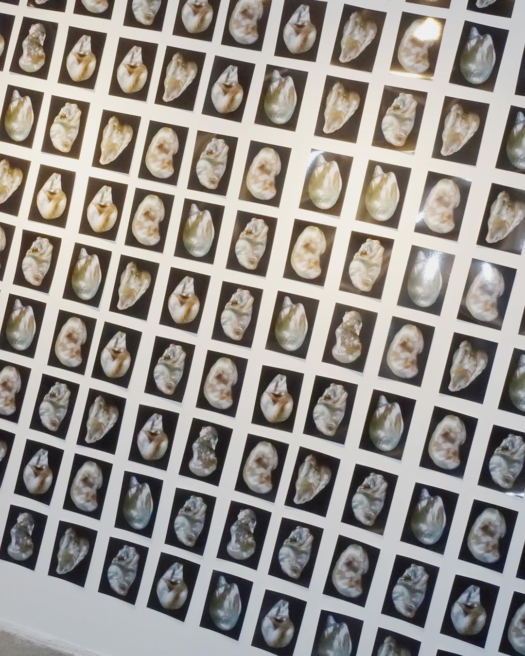 Array of tooth images displayed in a grid pattern against a white background, each encased in a black frame; dental art concept.