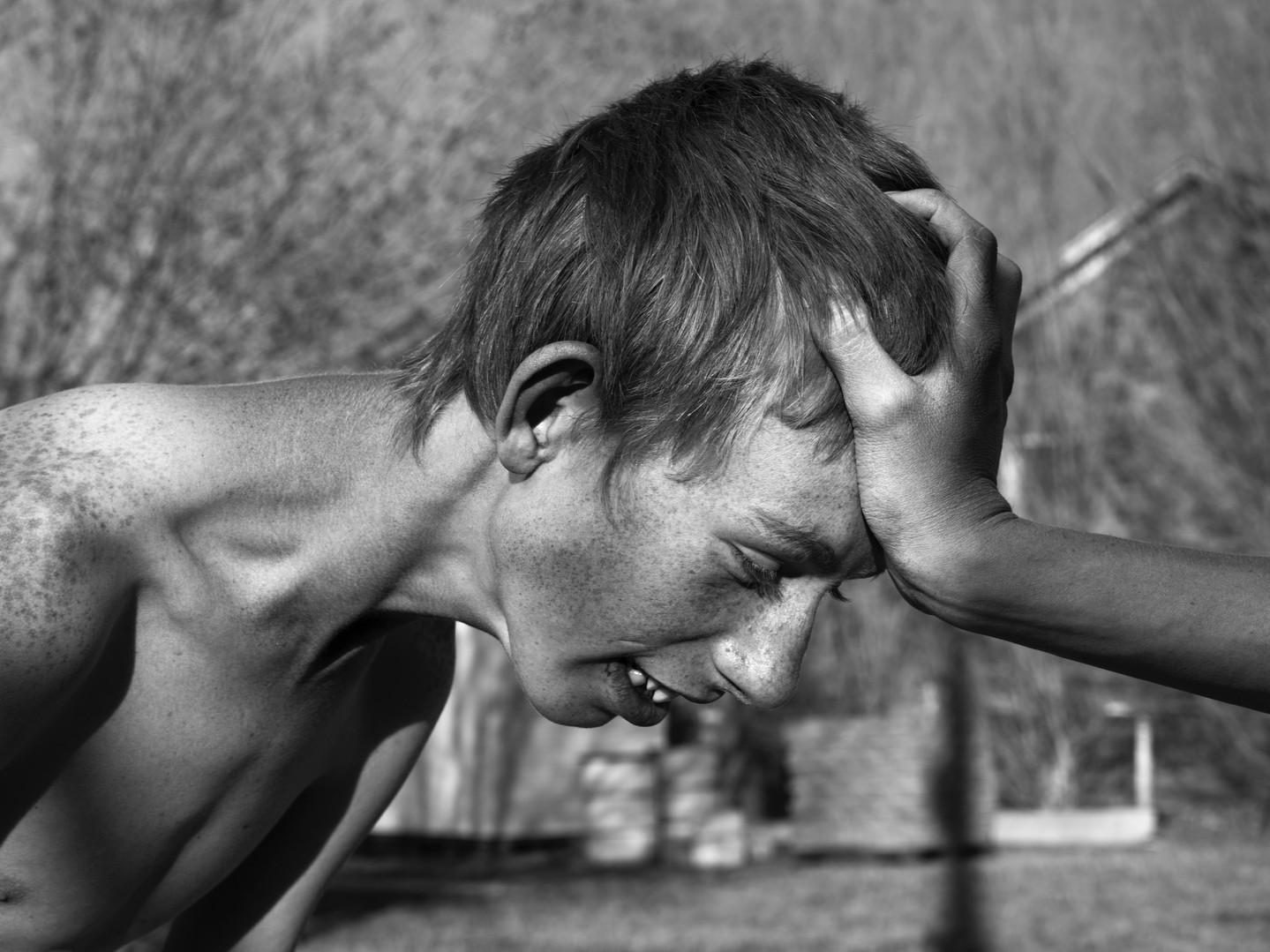 Black and white portrait of a shirtless young male with freckles, eyes closed, and hand on his head, expressing distress in an outdoor setting.