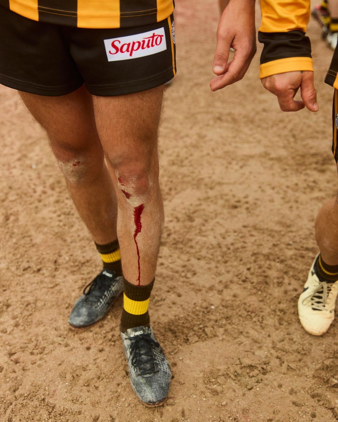 Injured rugby player with a bleeding knee on a dirt field wearing a team uniform with black and gold stripes, socks, and dirty cleats.