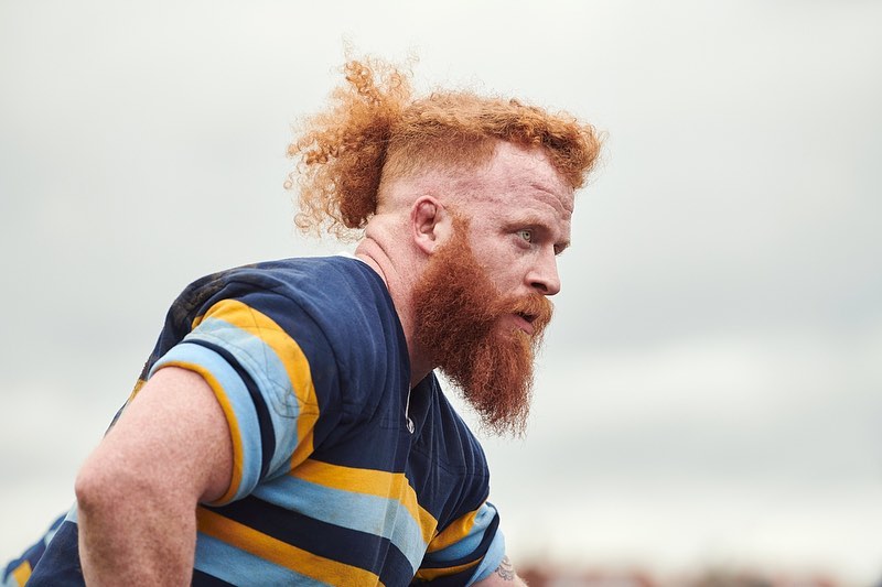 Close-up of a man with red hair and a full beard wearing a striped shirt looking off to the side against a cloudy sky background.