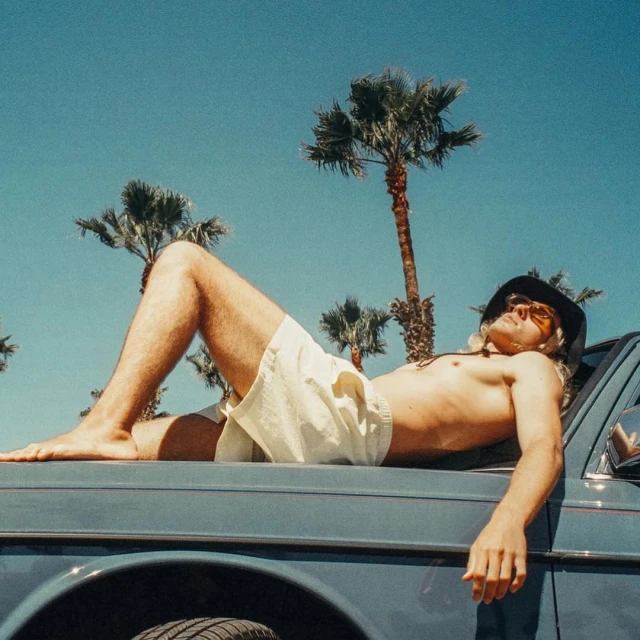 Man in shorts lies shirtless on a car hood beneath palm trees against a blue sky on a sunny day, evoking a relaxed summer vibe.