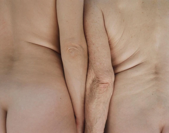 Close-up view of two nude human torsos, one fair and one elderly, pressed together. The left side is paler and smoother, while the right shows more wrinkles.