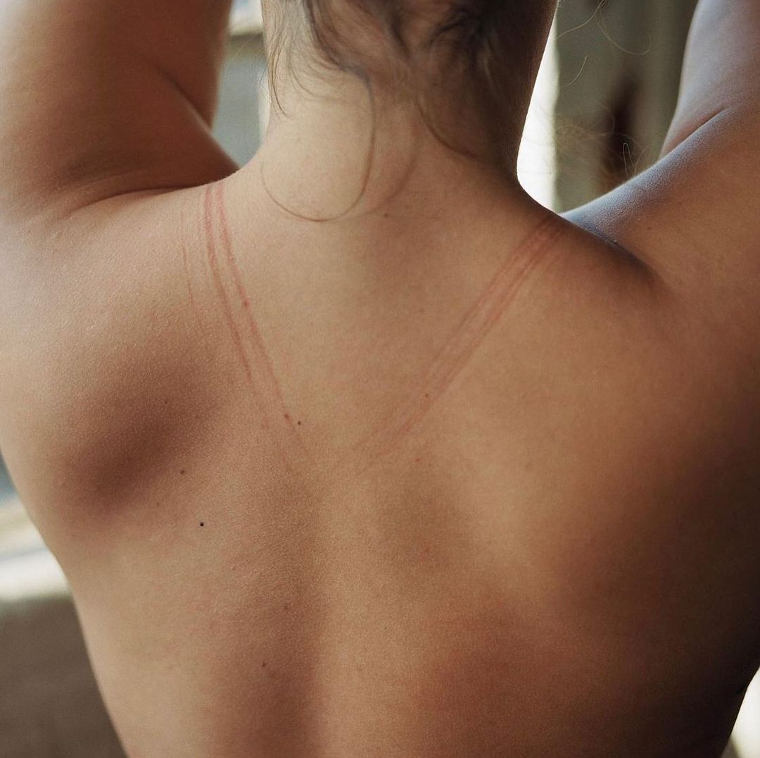 Nude back and shoulders of a female adult with tan lines and light skin in an indoor setting with natural window light.