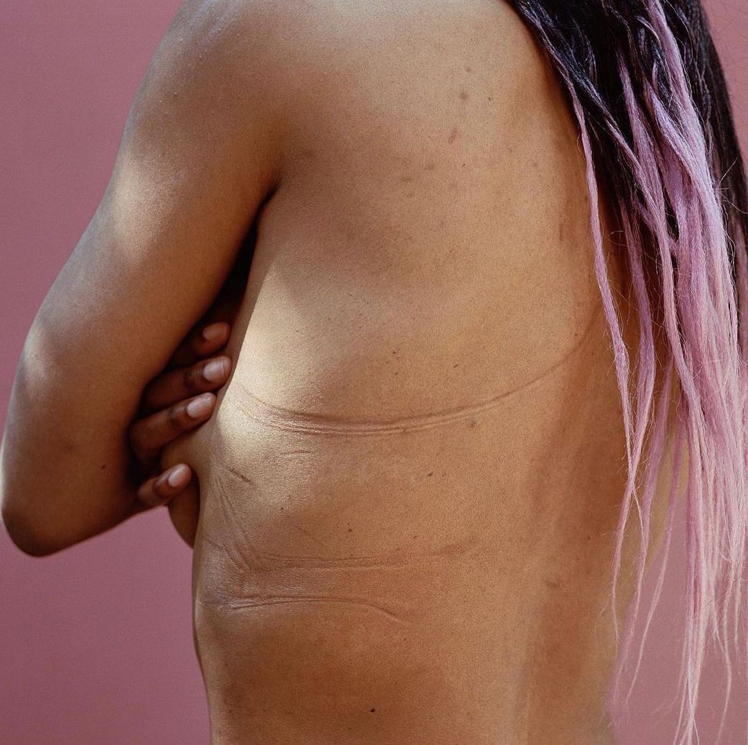 Back view of a person with crossed arms, showcasing skin texture and light against a pink background, highlighted by pink-tinted hair.