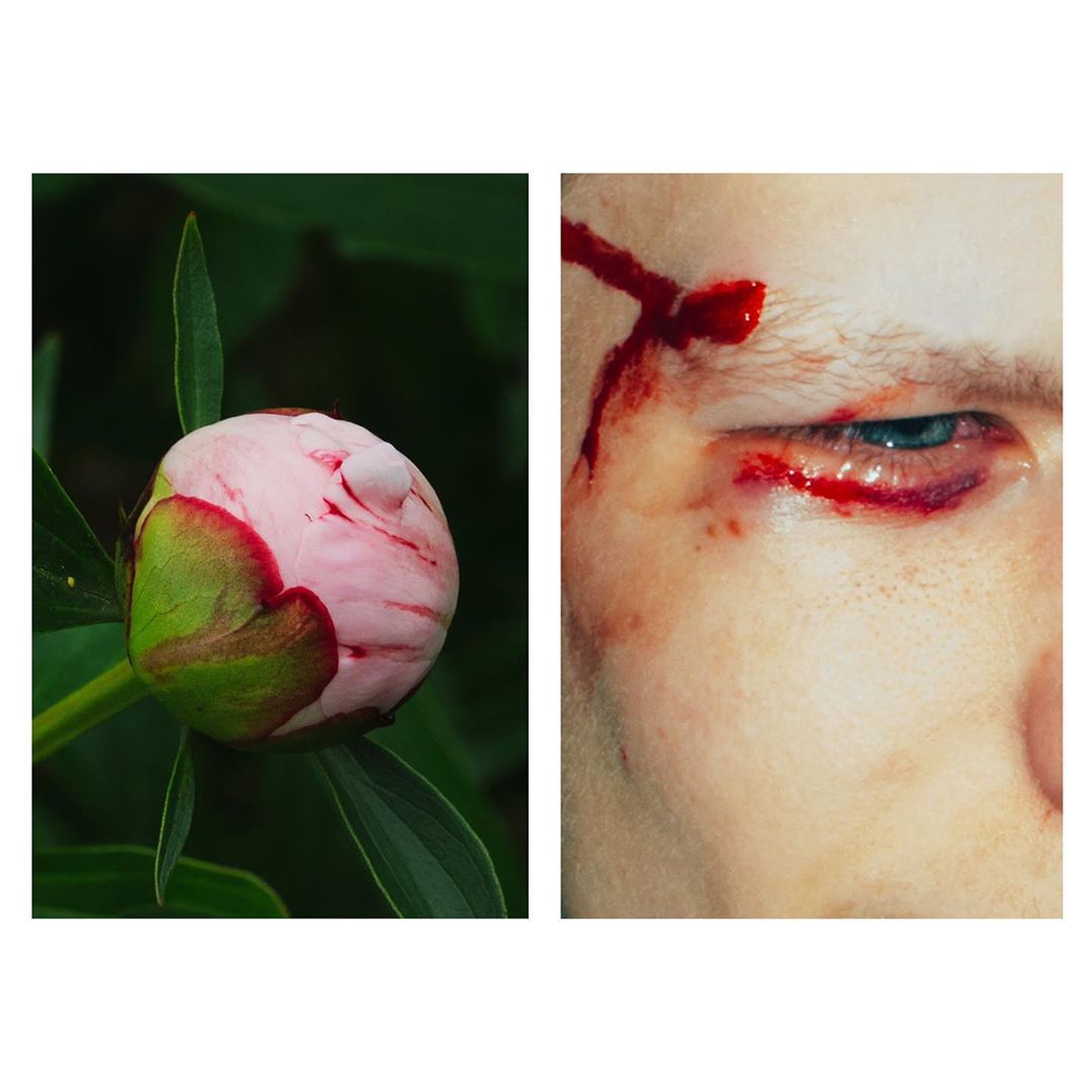 Juxtaposition of a peony bud and a close-up of an injured adult male's face with blood, creating a stark contrast in imagery.