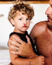 Close-up portrait of a toddler with curly blond hair and a minor nosebleed, held by an adult man.