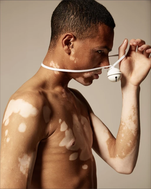 Close-up studio shot of a young adult male with vitiligo, holding a white bell ornament, against a neutral background. Minimalist aesthetic.