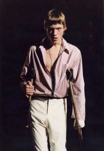 A person with crutches poses in a pink jacket and cream pants against a dark background, illuminated by a spotlight.