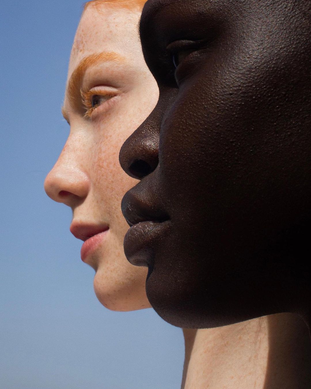 Close-up of two adult women with different skin tones, one with pale skin and freckles and the other with dark skin, set against a blue sky.
