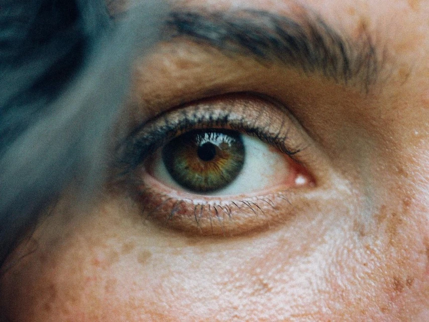 Close-up of a human eye with green and brown iris, surrounded by skin with freckles, and eyebrow visible. Macro photography of eye.