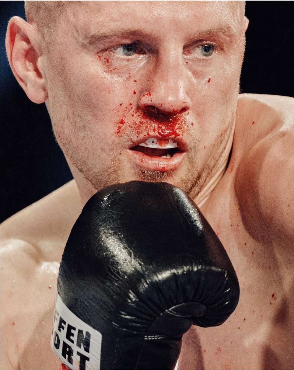 Close-up of a male boxer with blood on his face, wearing a black boxing glove, highlighting the intensity and physicality of the sport.