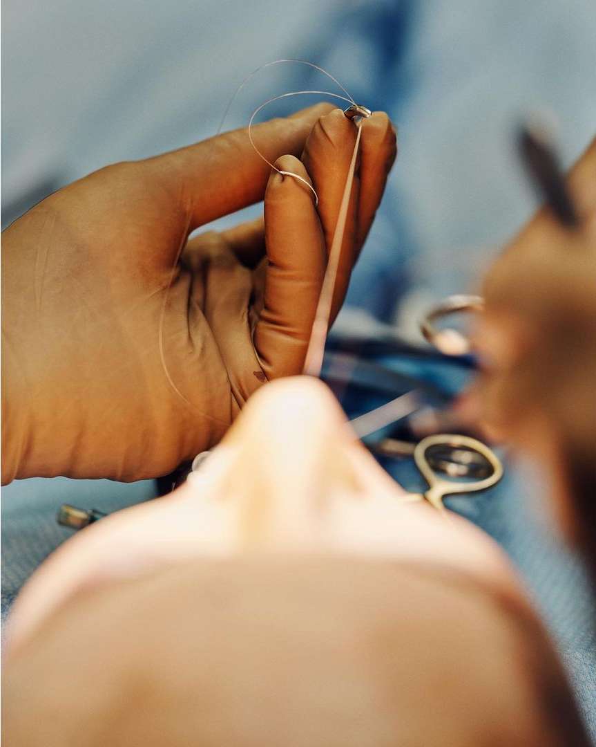 Surgeon wearing gloves holds a suture and needle above a patient's face in an operating room setting during a medical procedure.