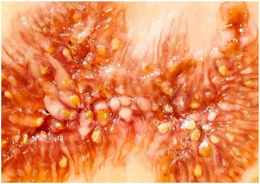 Extreme close-up of a fig fruit interior reveals a multitude of seeds and pulp, showcasing the fruit's texture and color.